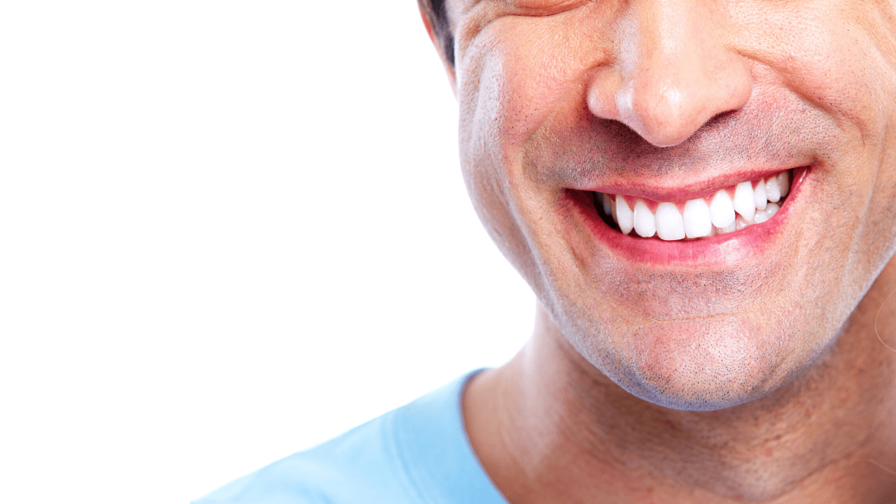 Extreme Smile Makeover: il sorriso che toglie 15 anni