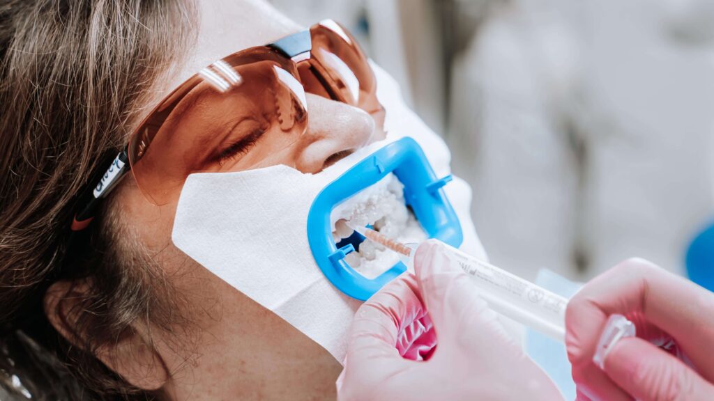 Una paziente che si sottopone al trattamento di sbiancamento dentale