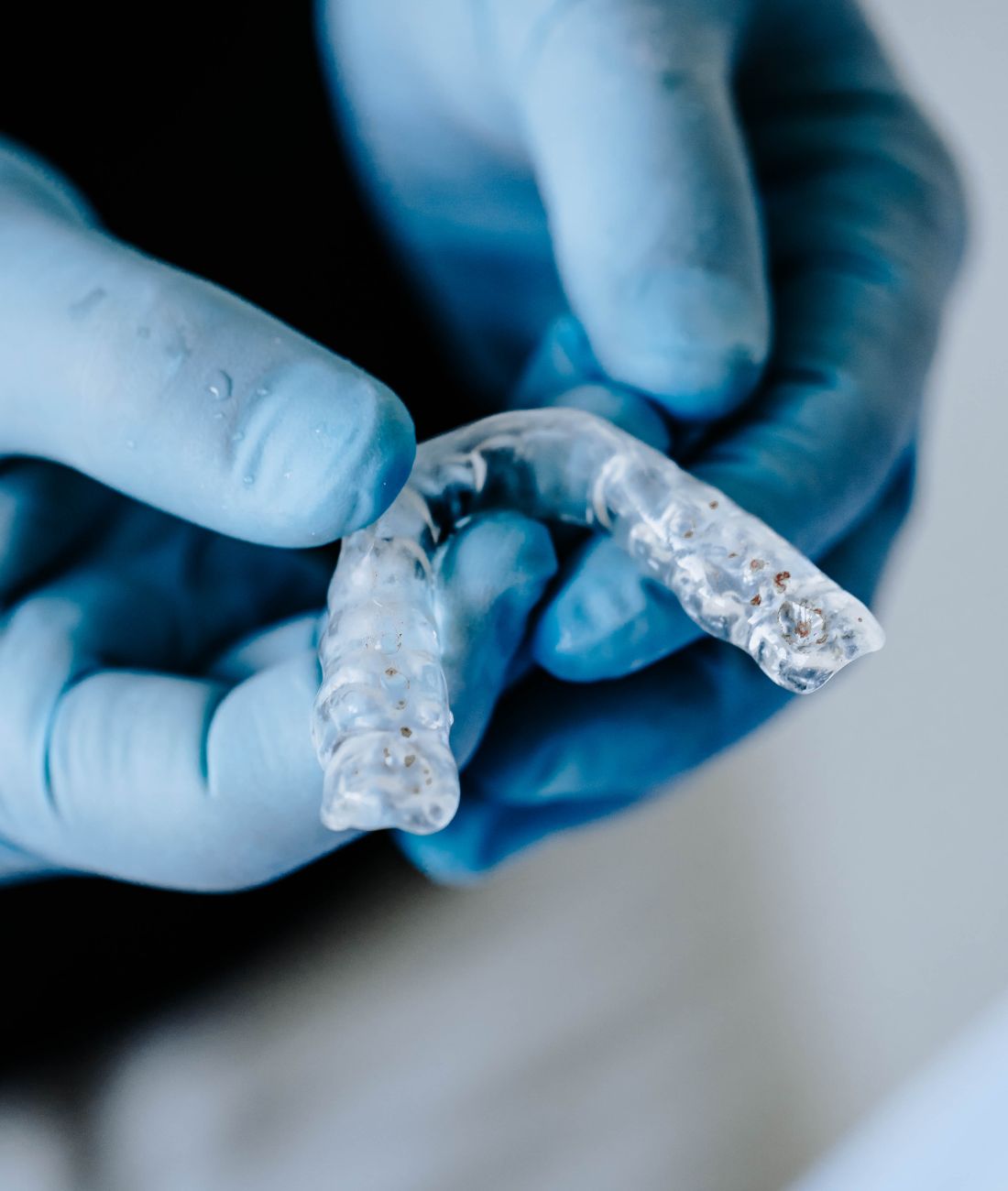 Un bite tenuto in mano da uno dei dentisti Tredent