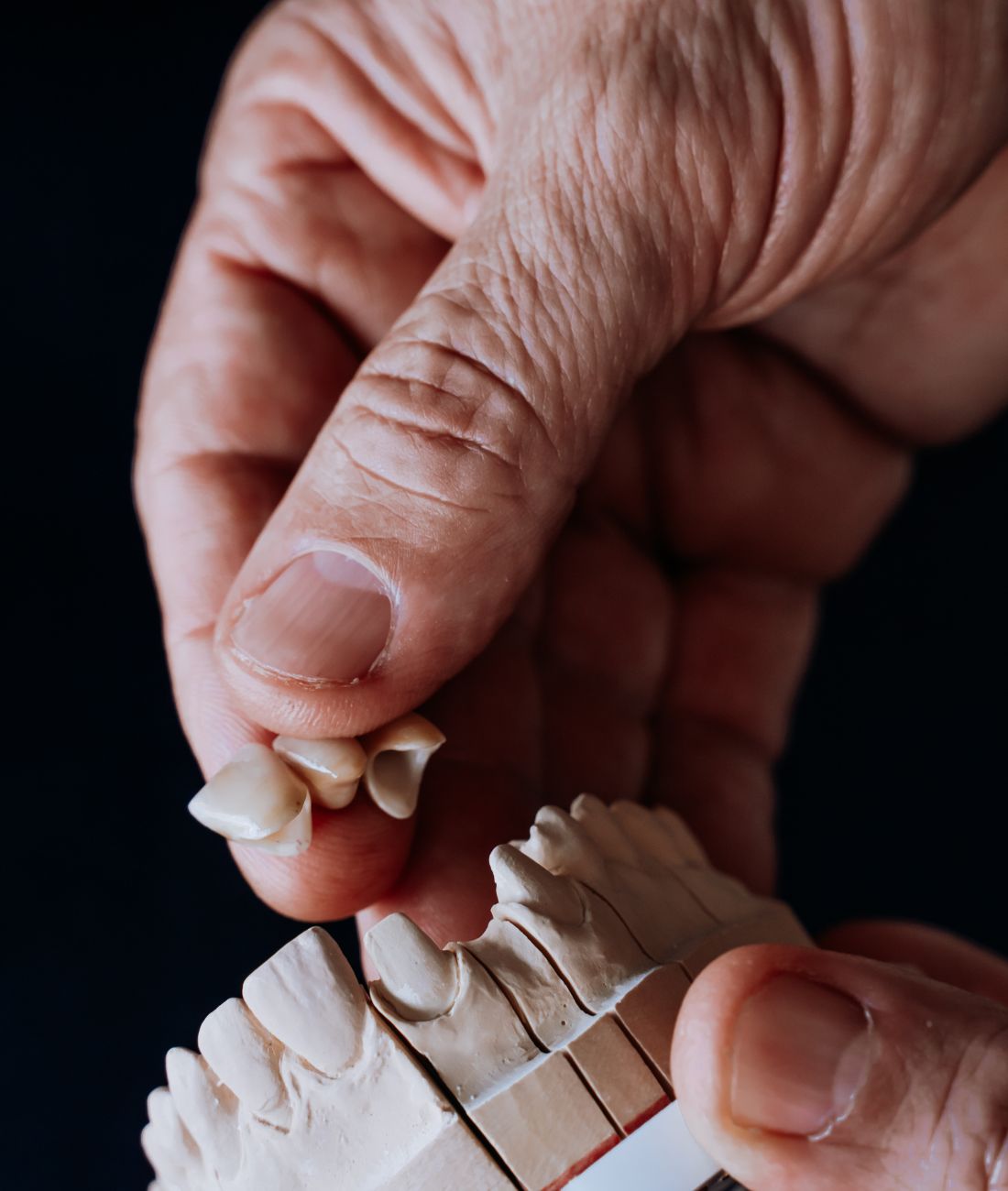 Modellino di un'arcata inferiore