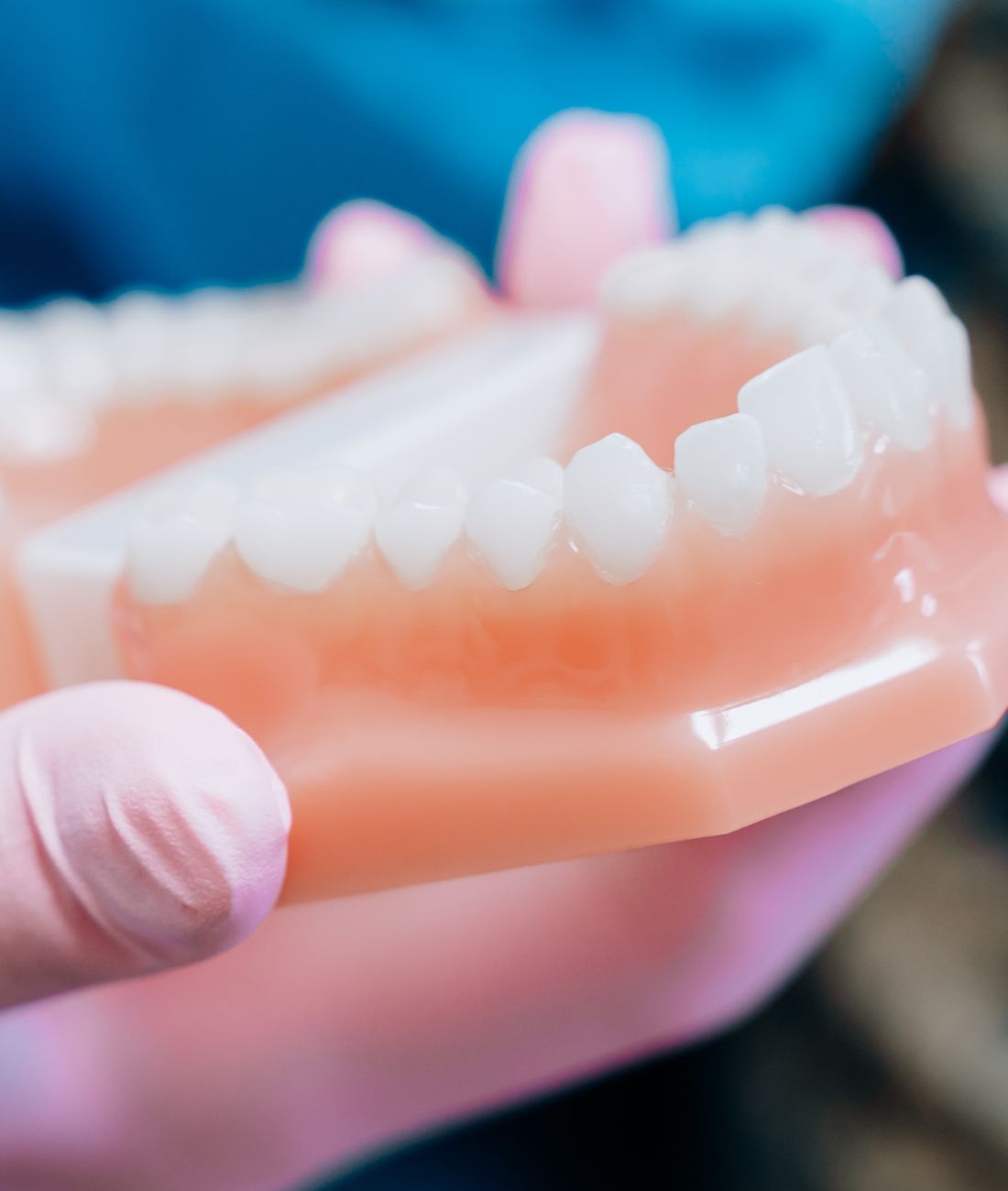 Allineatori trasparenti Invisalign