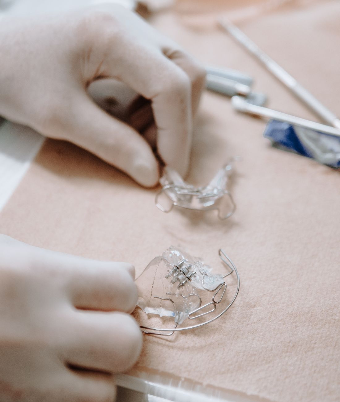 Dettaglio fotografico di un apparecchio ortodontico mobile.