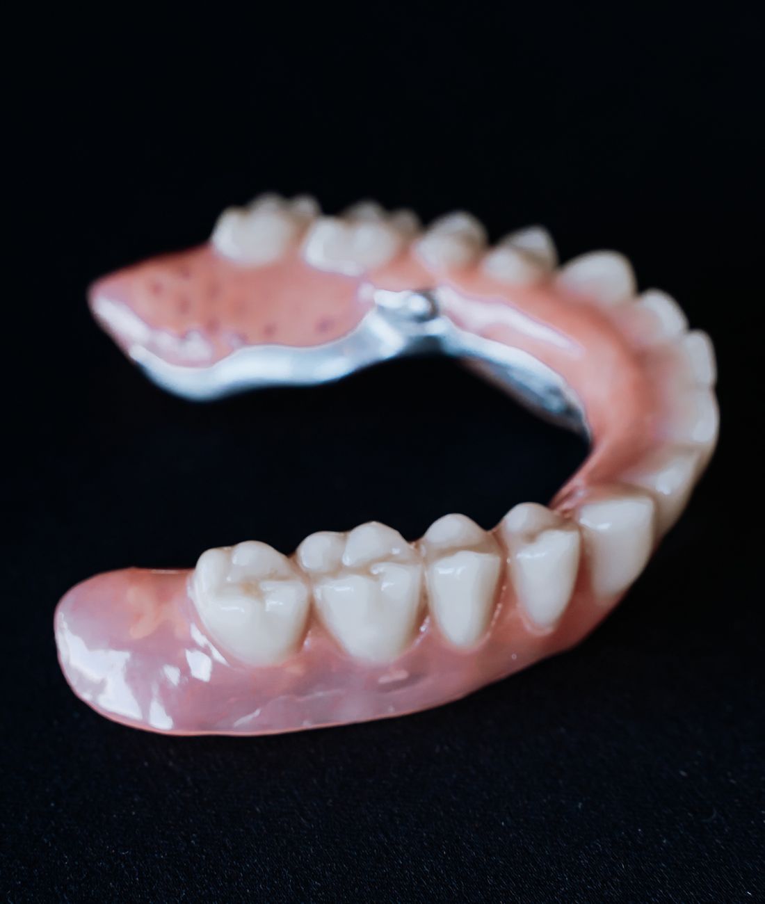 Foto di una protesi fissa.