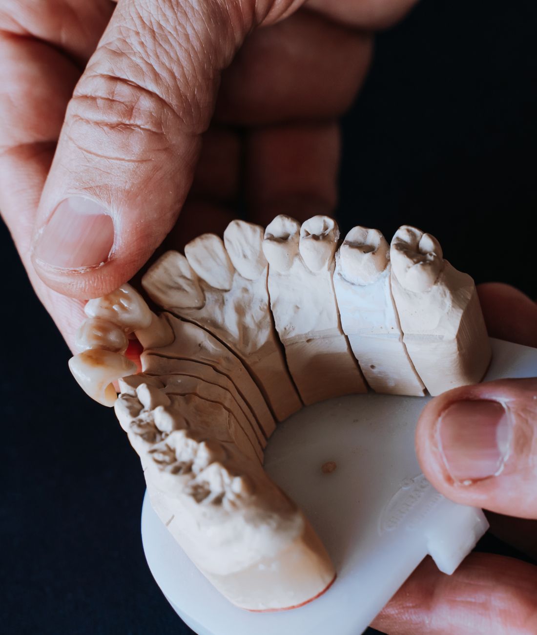 Protesi removibili su modellino