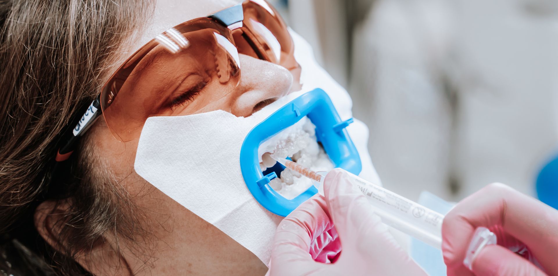 Una paziente che effettua lo sbiancamento dentale